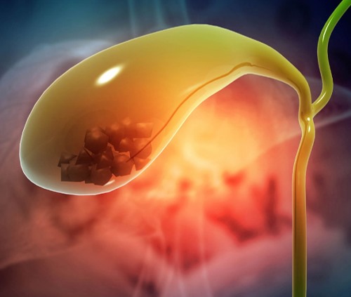 Diabetic Surgery in Jalandhar, Gastric Bypass Surgery Punjab 